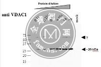 VDAC1蛋白|外线粒体膜蛋白porin 1